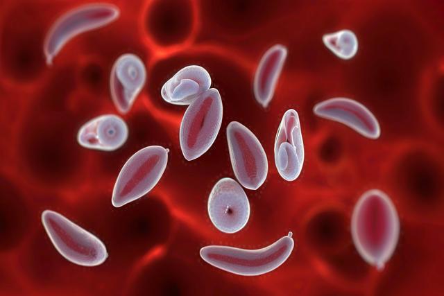 Razumevanje okužbe s toksoplazmo gondii pri mačkah in psih: simptomi, diagnoza in zdravljenje