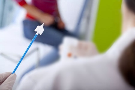 Napredek pri presejanju raka materničnega vratu: vloga HPV testov samokamenja
