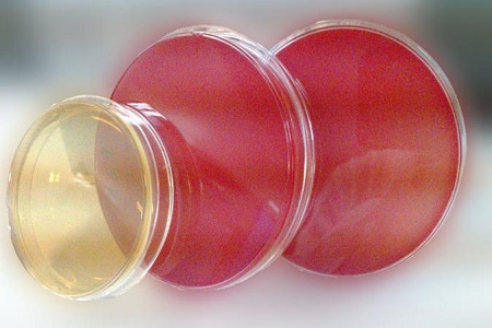 Salmonella Shigella agar (SS): Essential Medium za izolacijo patogenov