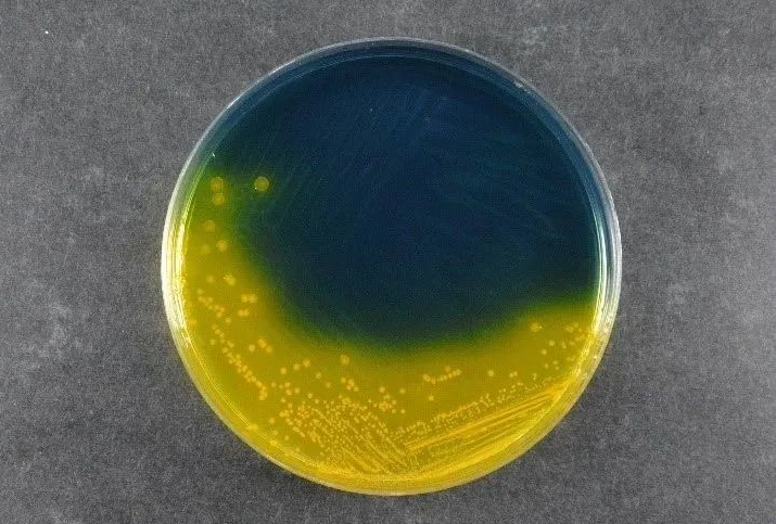 Zagotavljanje varnosti hrane: Babio's Salmonella Shigella Agar (SS) podpira globalne standarde odkrivanja patogenov