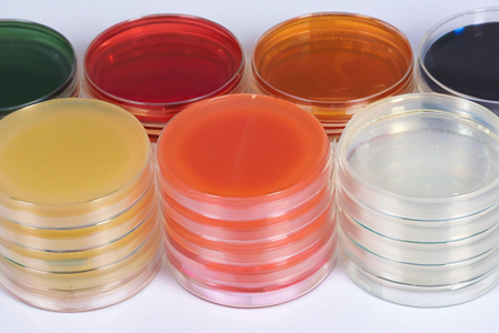 Triple Sugar Iron Agar (TSI): Natančna diferenciacija enteričnih bacilov z Babiom