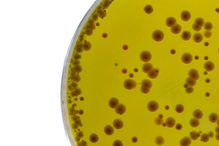 Babio zažene visokokakovostno bazo baird-parkerja za zanesljivo testiranje Staphylococci