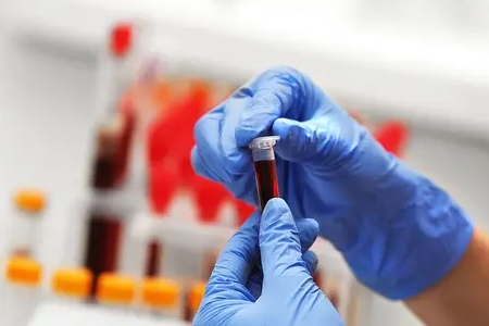 BABIO lansira fluorescenčni hitri test brejosti goveda